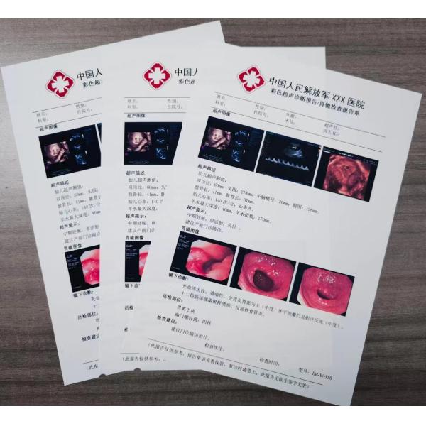 180 Microns White Glossy 17X30m Inkjet X Ray Film Eco Friendly