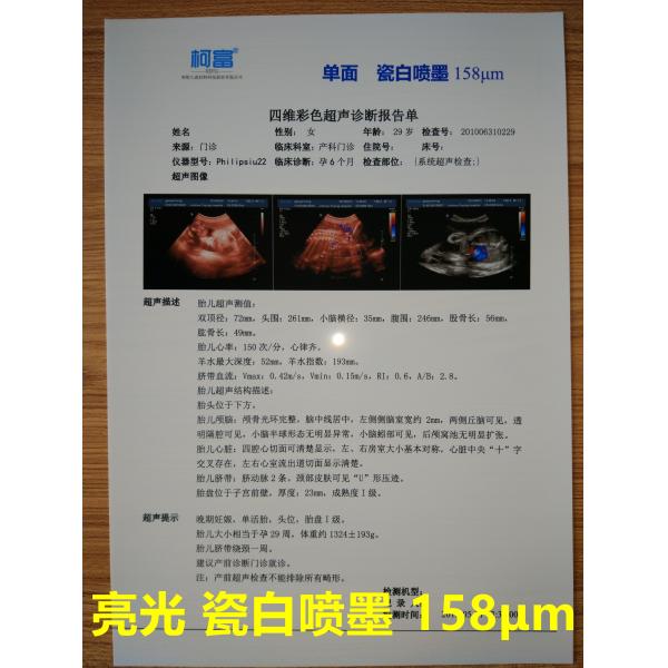 125 Microns White Base Opaque Inkjet Medical Film Three Dimensional CT Scan Film