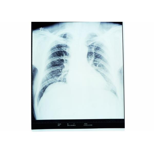 Dry X Ray Medical Diagnostic Imaging Radiology For AGFA / FUJI 2000