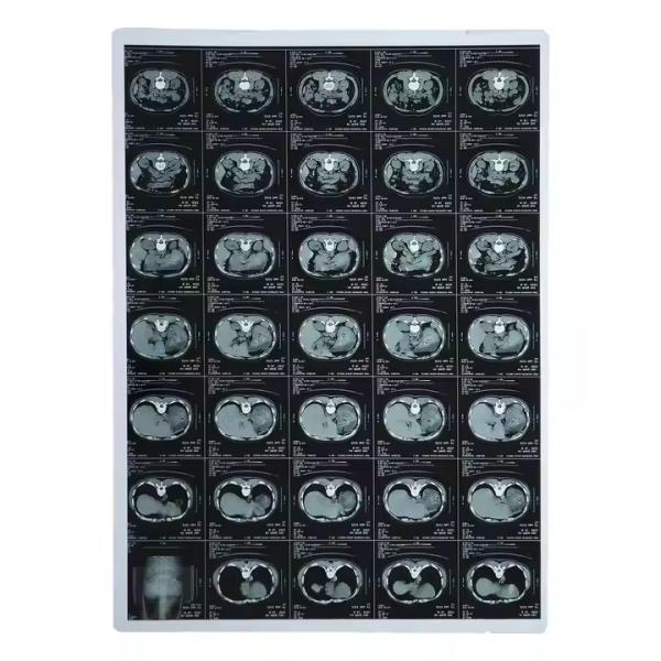 Inkjet Printing Dry Laser X Ray Imaging Film For Hospital Medial Devices