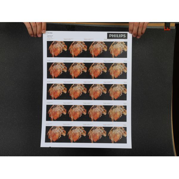 PET White Radiology Inkjet Printing Film A3 Plus Endoscopic Ultrasound Image X