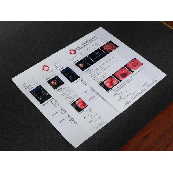 A4 A3 13X17 PET X Ray Film White Inkjet Medical Dry Film For Epson Printer