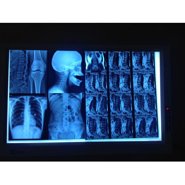 Low Fog Medical Dry Imaging Film For AGFA5300 / Fuji3000 14 x 17inch