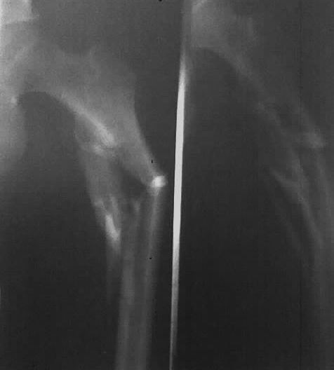 Fuji Medical Thermal Printer Film