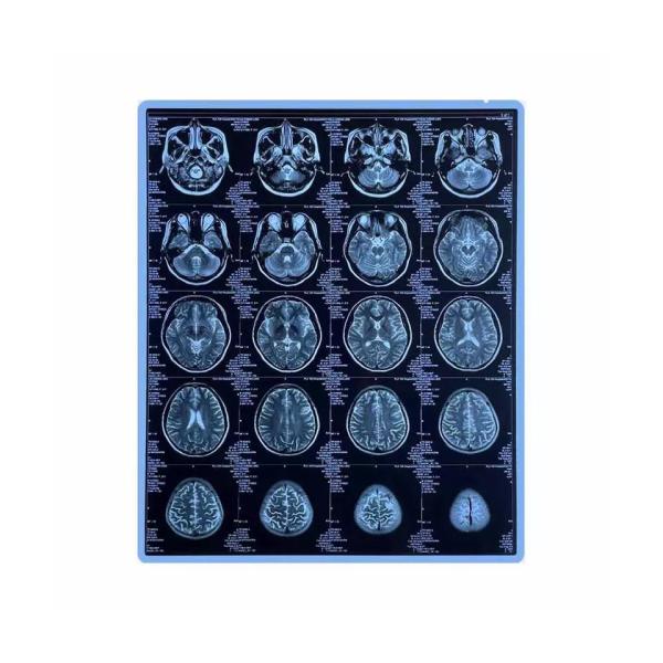 CE Printable Blue Medical X Ray Film 11x14 Inch Pet Inkjet Film