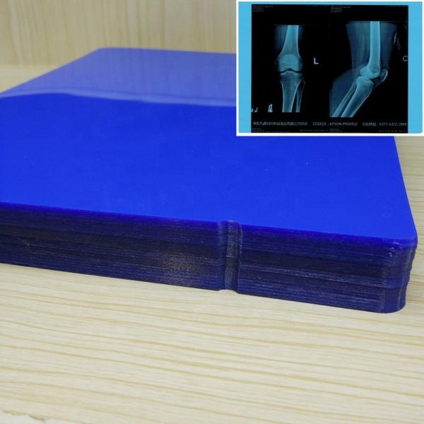 ISO9001 Blue Inkjet Film Medical Inkjet Printing Film 11*14In