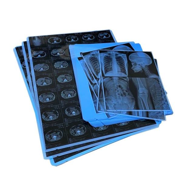 210um Waterproof Medical Dry Film Inkjet Printing Film 14x17 Inch