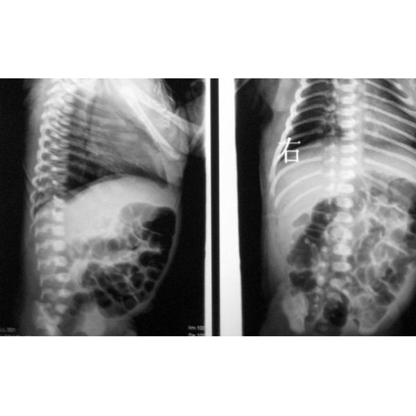 10 x 14inch Dry Medical X Ray Films For Fuji 3000 / 2000 / 1000