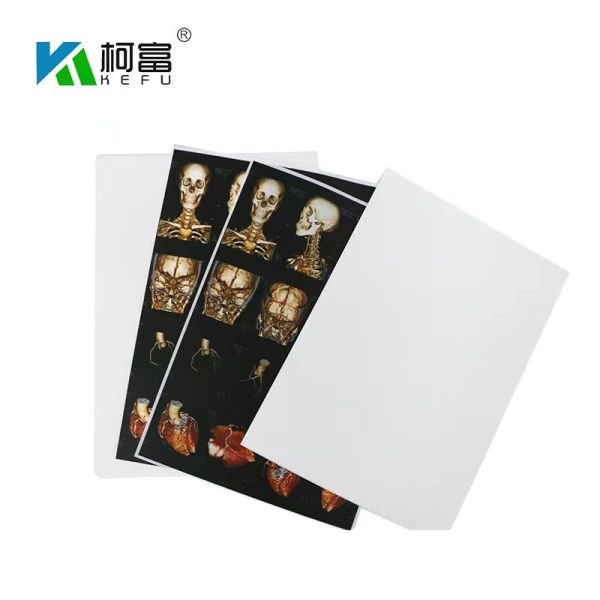 ISO9001 White Inkjet X Ray Film A4 Medical Dry Film OEM