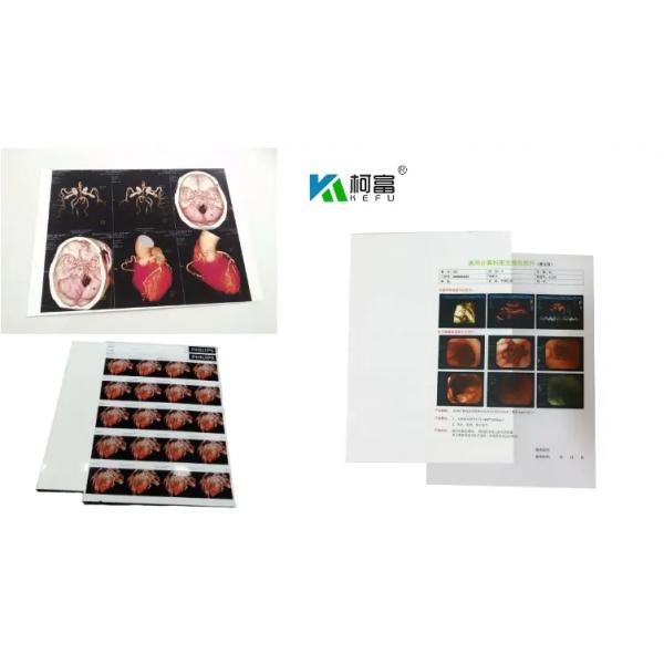 204±8 μM Thickness Medical Dry Film With High Durability ≤20% Haze UV Resistance