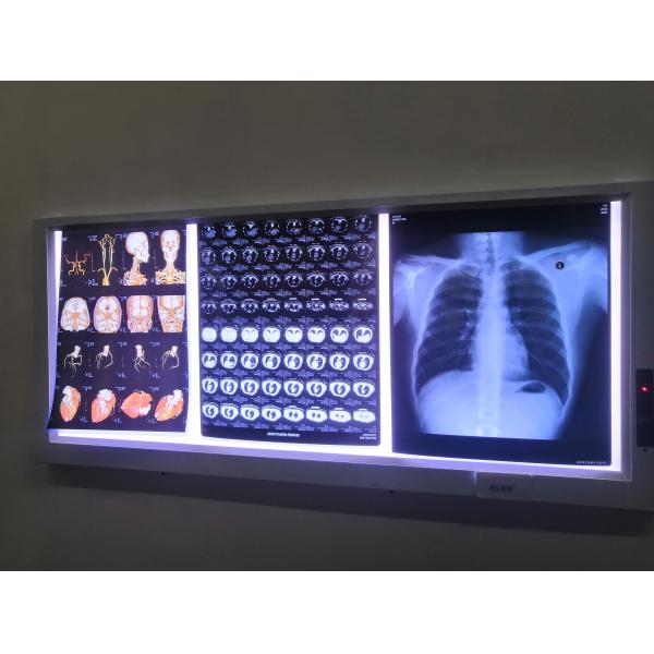 180 Microns White Glossy 17