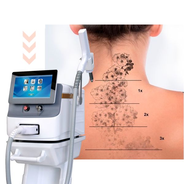 Commercial OPT 585nm Picosecond Laser Machine Tattoo Removal Beauty Machine
