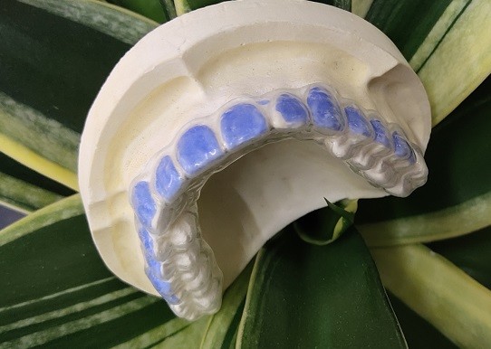 ISO13485 Teeth Whitening Bleach Guard For Smoke Stains