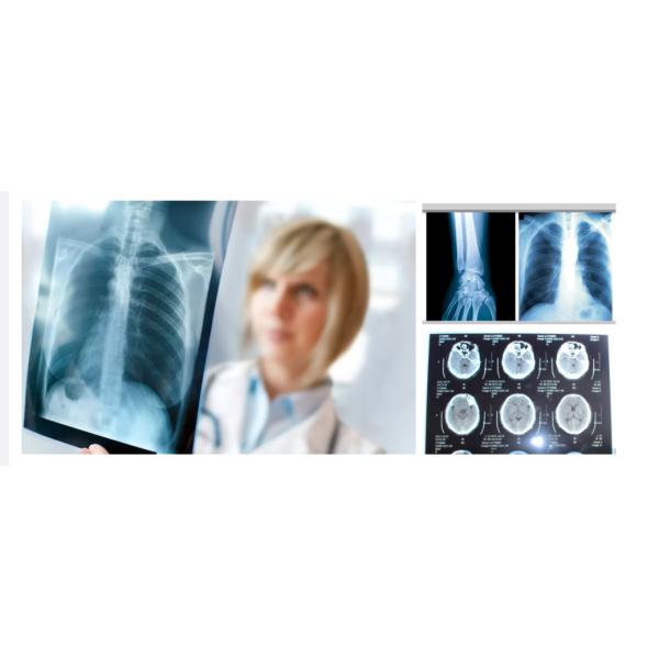 ISO13485 Blue Base Inkjet X Ray Film CR DR MRI CT DSA Medical Dry Film