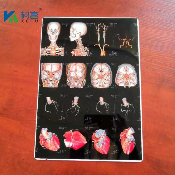 ISO9001 White Inkjet X Ray Film A4 Medical Dry Film OEM