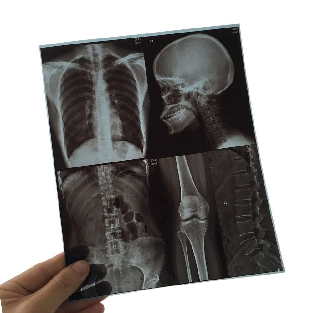 11X14 Inch Medical X-ray Film / Analogue Medical Film / Dry Film
