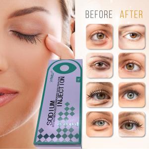 China Hyamely Removing Dark Circles Injection Filling Tear Troughs 1ml on sale