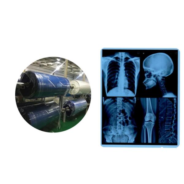 11X14 Inch Medical X-ray Film / Analogue Medical Film / Dry Film