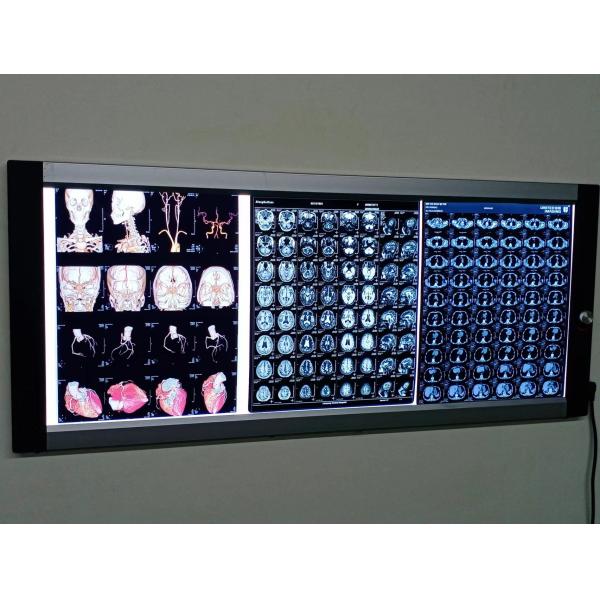 Canon Epson Inkjet X Ray Film 36''X30m Printable Blue X Ray Film