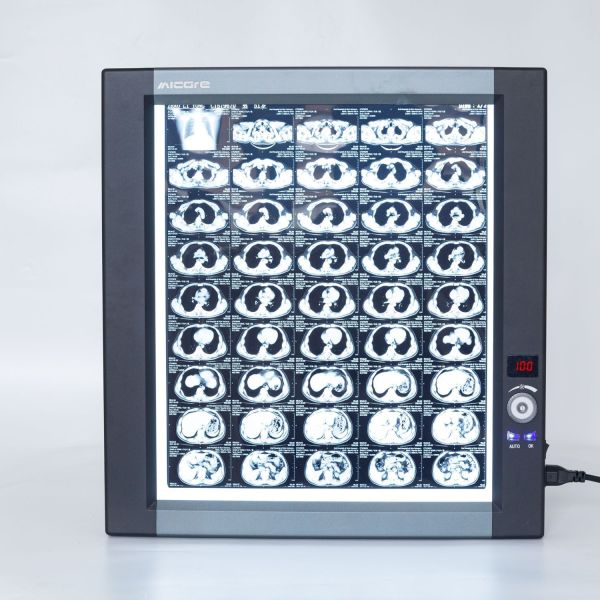 Desktop LED X Ray Viewer 1920X1080 Medical X Ray Viewer For Viewing And Analyzing Medical Images