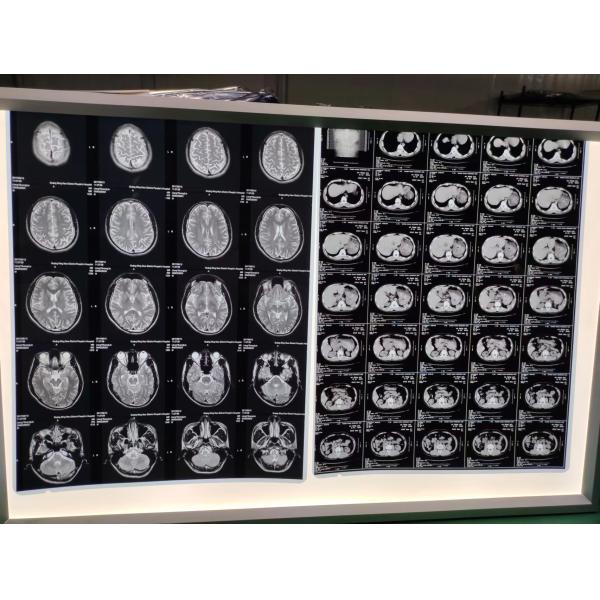 OEM ODM Medical X Ray Film Inkjet X Ray Film Compatible With Dye Pigment Ink