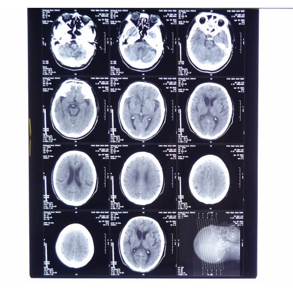 Custom 8 X 10 Digital Medical Dry Film