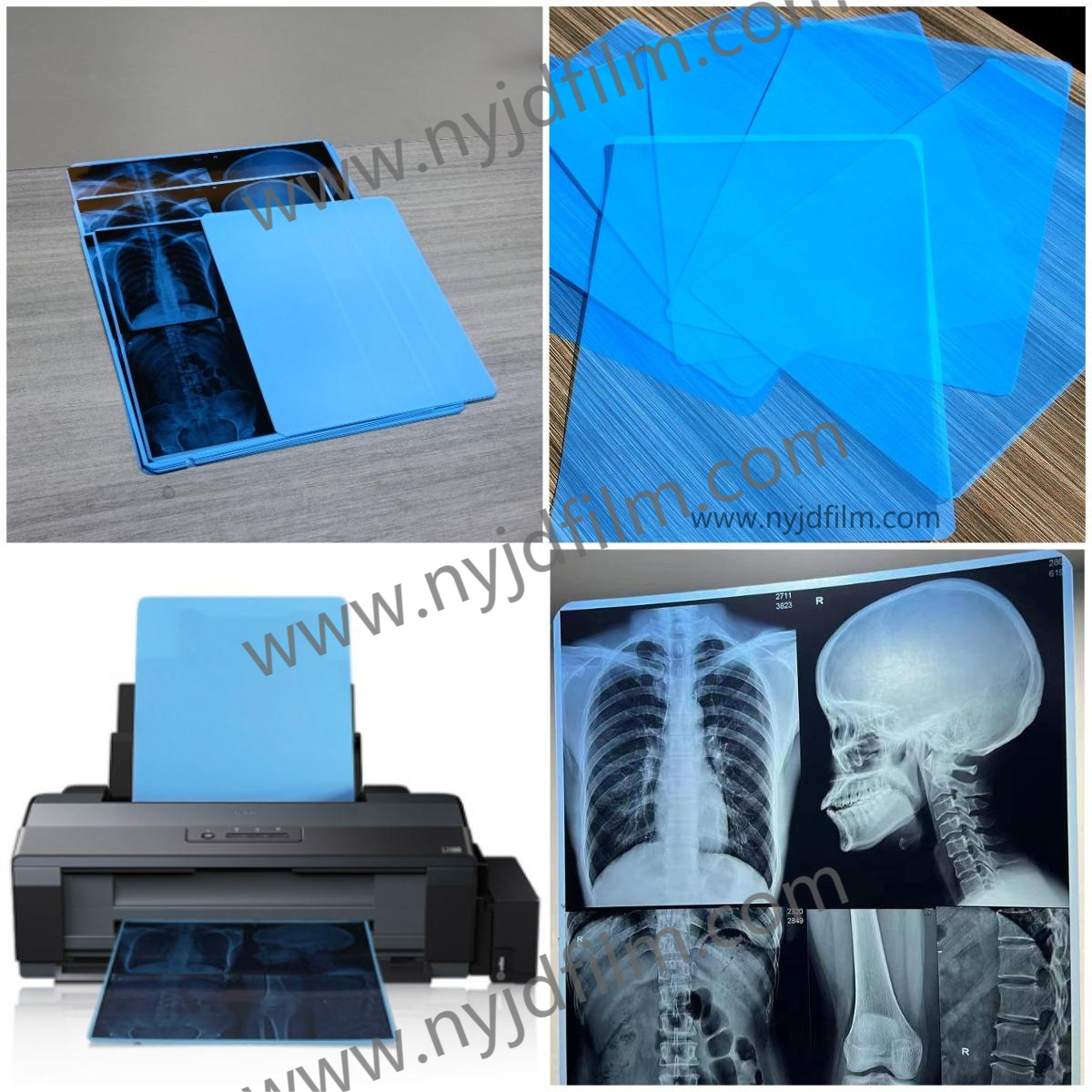 ISO9001 Blue Inkjet Film Medical Inkjet Printing Film 11*14In