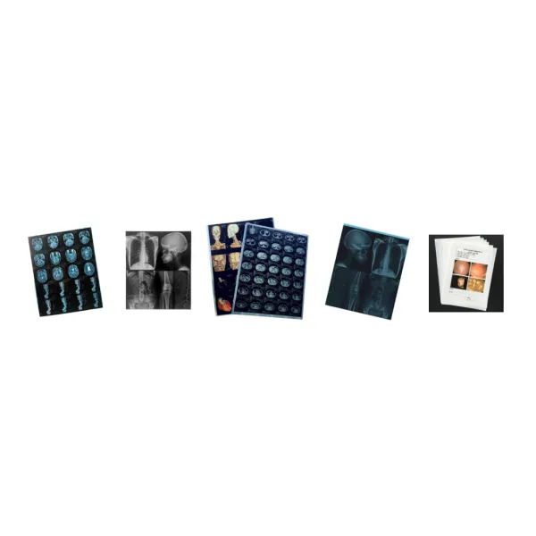 11X14 Inch Medical X-ray Film / Analogue Medical Film / Dry Film