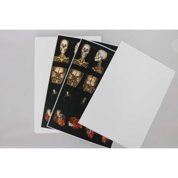 ISO14001 Digital X Ray Film Medical X Ray Film 10x12 Inch