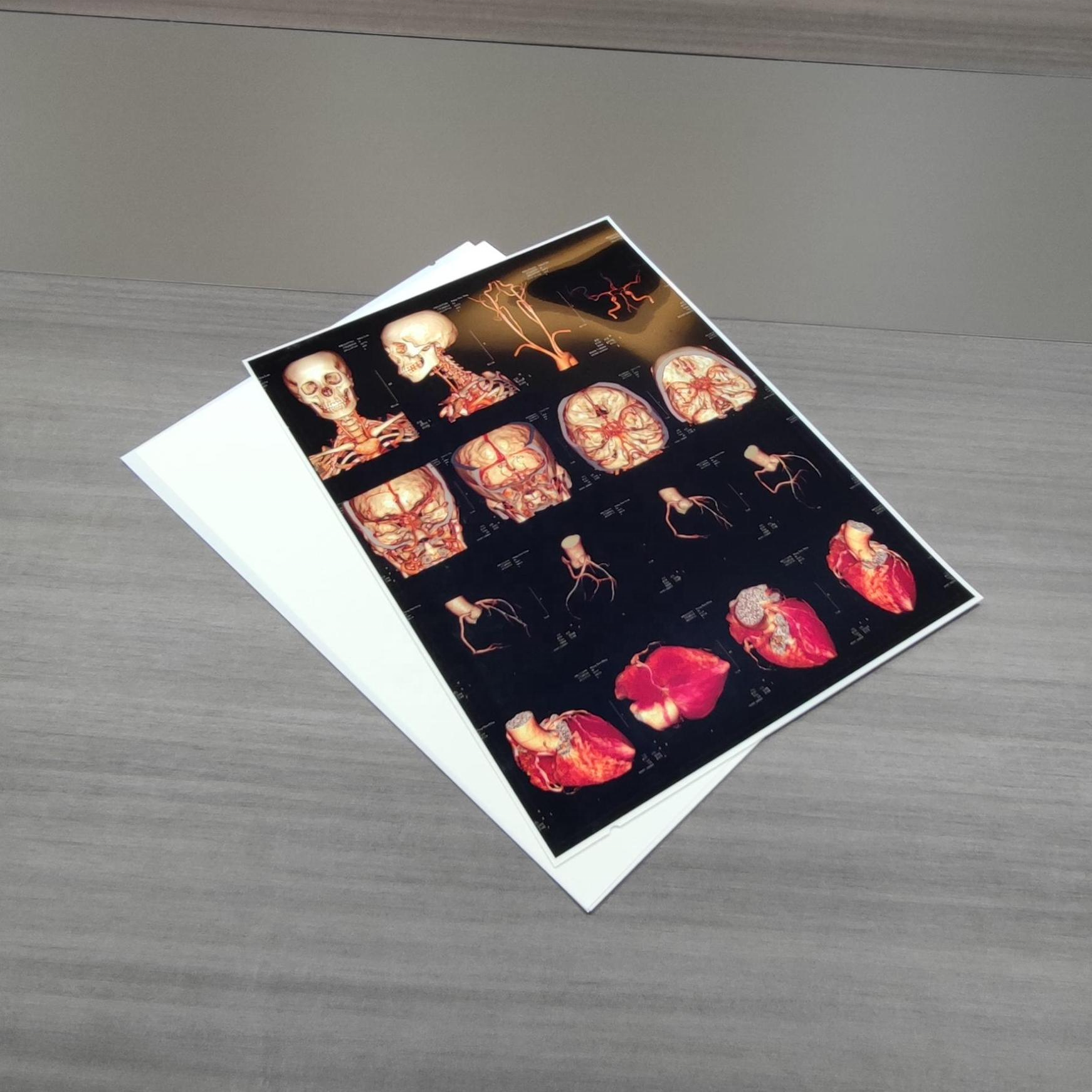 13X17'' White 180 Microns PET X Ray Film Sheets Transparency Film For Inkjet Printers